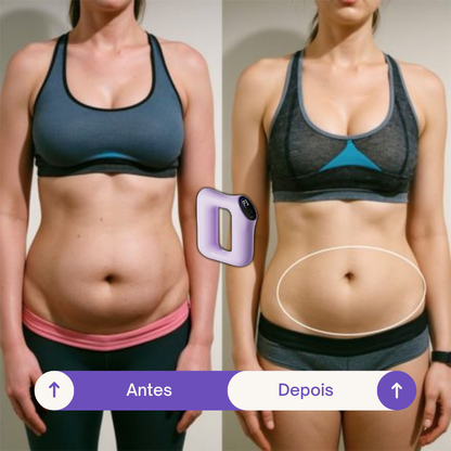 SlimShape - Anel Massageador