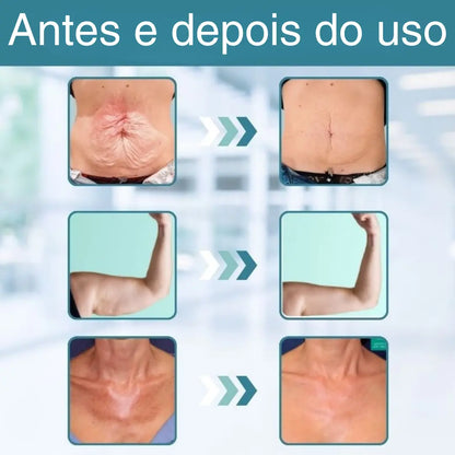 GlowEssence™ | Firma a pele flácida em 97% em apenas 24 horas!