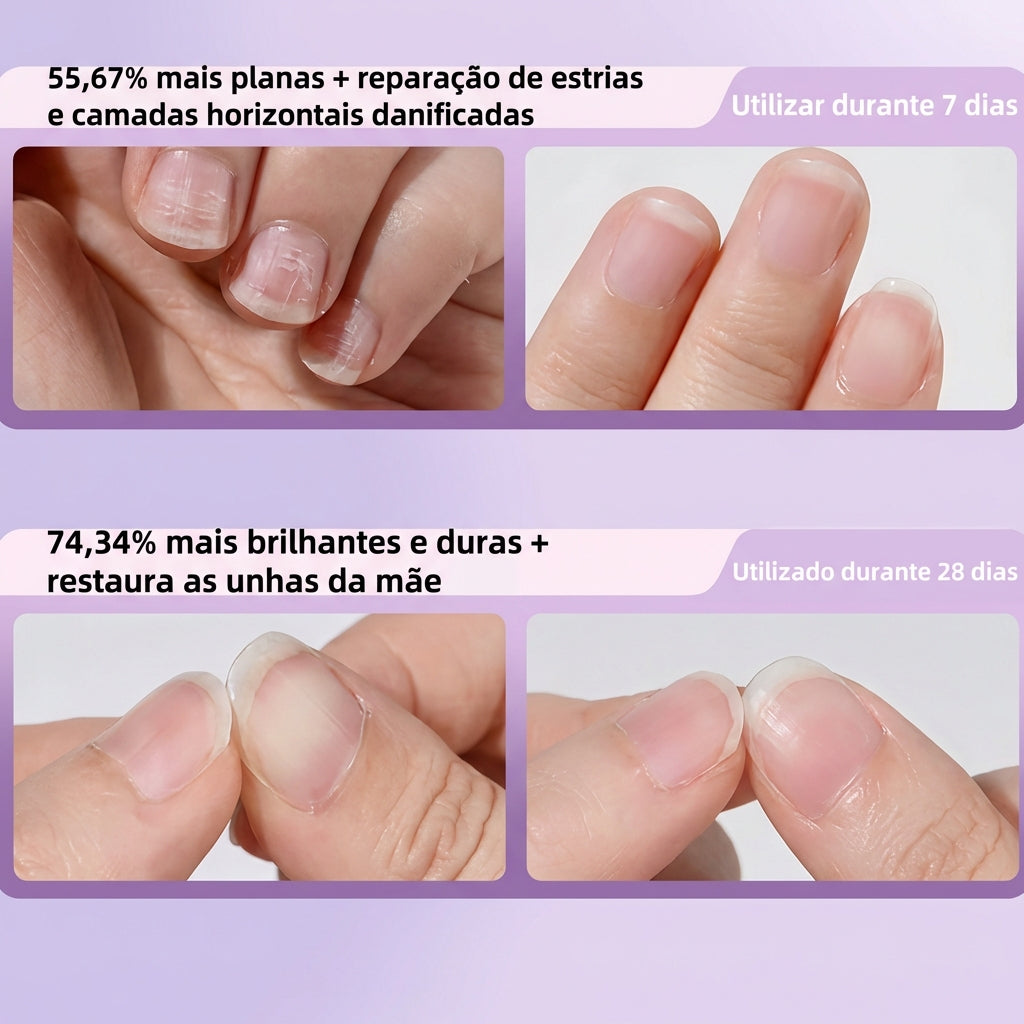 Caneta 3 em 1 para Unhas Fortes, Hidratadas e Perfumadas