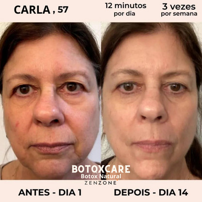 Magic Care Laser 4 em 1 (Portes Grátis Esta Semana)