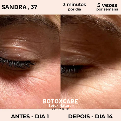 Magic Care Laser 4 em 1 (Portes Grátis Esta Semana)