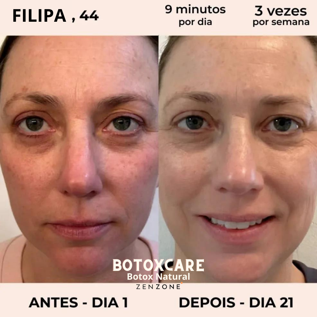 Magic Care Laser 4 em 1 (Portes Grátis Esta Semana)